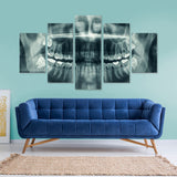Xray See Through Dentist 5 Piece Canvas Wall Art